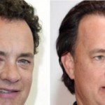 Tom Hanks: Il divo e il trapianto di capelli