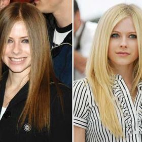 Avril Lavigne rinoplastica prima dopo