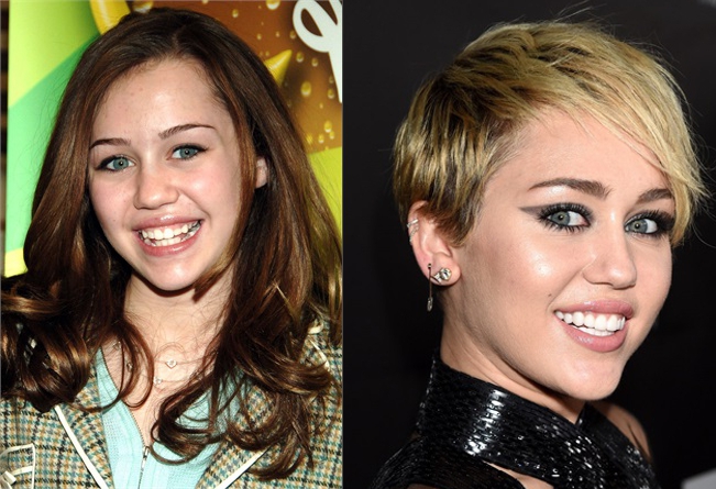 Miley Cyrus denti rifatti